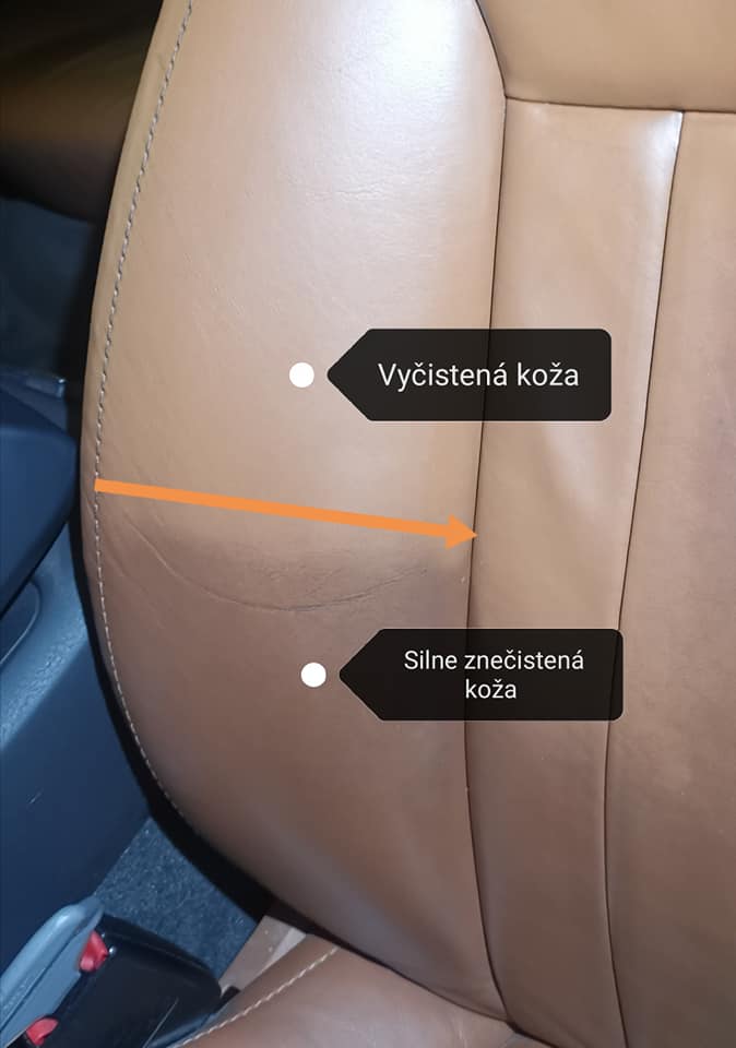 autokoza
